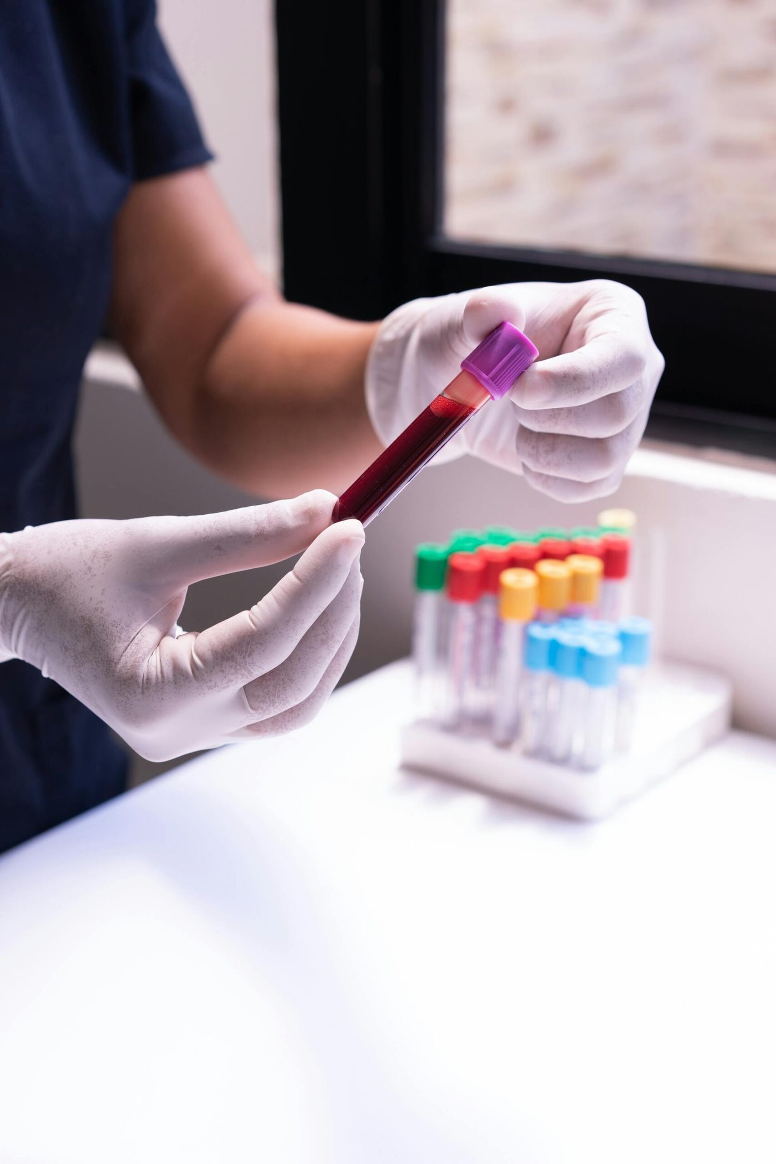 Blood sample test tubes in a lab